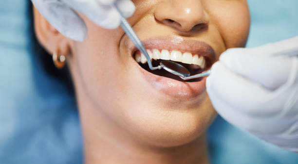 Best Emergency Root Canal Treatment in Erma, NJ