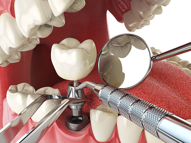 Best Emergency Tooth Extraction in Erma, NJ